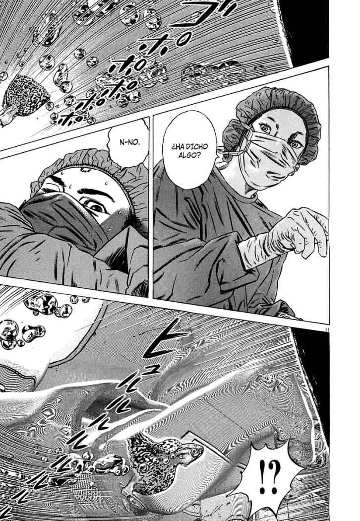 Read Homunculus ES Manga Online